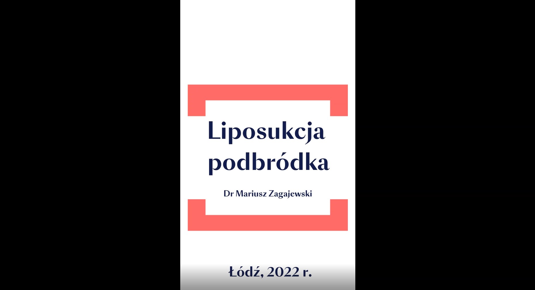 Liposukcja podbródka - opis i przebieg zabiegu w Centrum Medyczne MultiClinic w Łodzi
